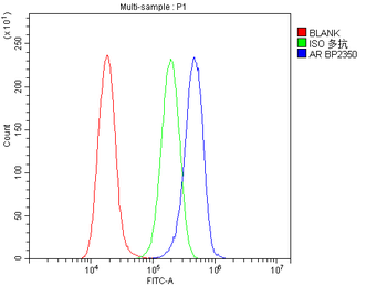 Androgen Receptor/AR Rabbit Polyclonal Antibody
