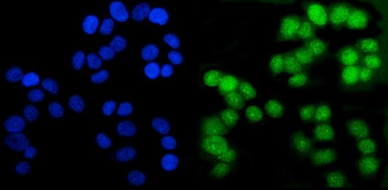 Anti-Androgen Receptor/AR Antibody