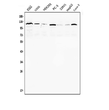 Anti-Androgen Receptor/AR Antibody