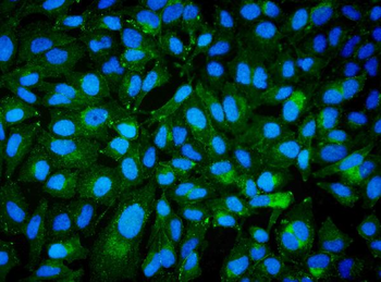 Anti-CD239/BCAM Antibody