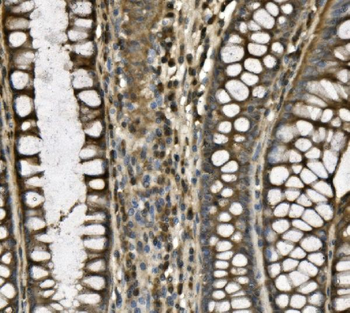 Anti-CD239/BCAM Antibody