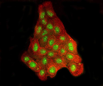 Anti-BRD2 Antibody