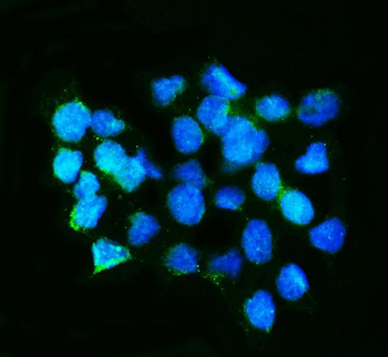 Anti-Calretinin/CALB2 Antibody