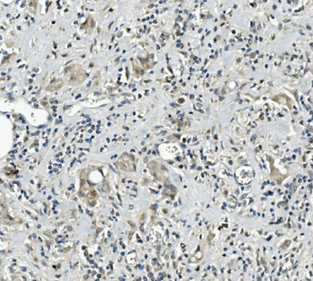 Anti-Calretinin/CALB2 Antibody