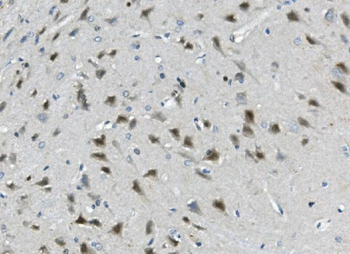 Anti-Calretinin/CALB2 Antibody