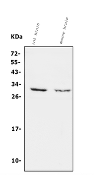 Anti-Calretinin/CALB2 Antibody