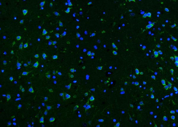 Anti-CaMKII alpha/CAMK2A Antibody