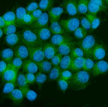 Anti-CaMKII alpha/CAMK2A Antibody
