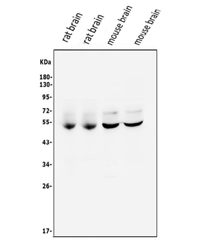 Anti-CaMKII alpha/CAMK2A Antibody