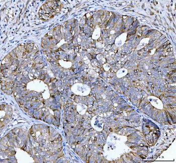 Anti-Cyclin B1/CCNB1 Antibody