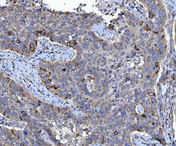 Anti-Cyclin B1/CCNB1 Antibody