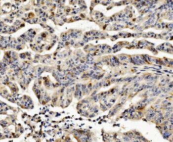 Anti-Cyclin B1/CCNB1 Antibody
