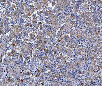Anti-Cyclin B1/CCNB1 Antibody