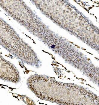 Anti-Cyclin B1/CCNB1 Antibody
