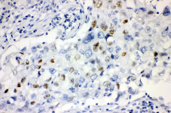 Anti-Cyclin E1/CCNE1 Antibody
