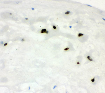 Anti-Cyclin E1/CCNE1 Antibody