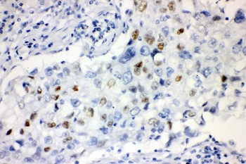 Cyclin E1/CCNE1 Antibody