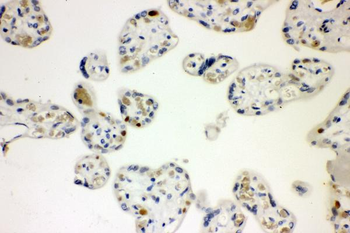 Anti-Cyclin E1/CCNE1 Antibody