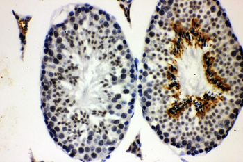 Anti-Cyclin E1/CCNE1 Antibody