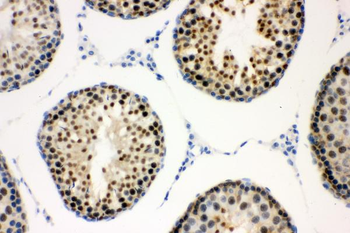 Anti-Cyclin E1/CCNE1 Antibody