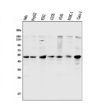 Anti-Cyclin E1/CCNE1 Antibody