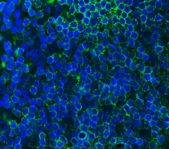 Anti-Cd79a Antibody