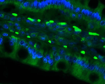 Anti-Cd79a Antibody