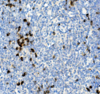 Anti-Cd79a Antibody