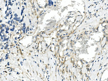 Anti-CDR2 Antibody
