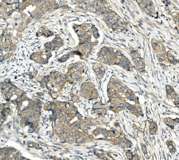Anti-CDR2 Antibody
