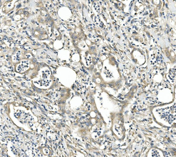 Anti-CDR2 Antibody
