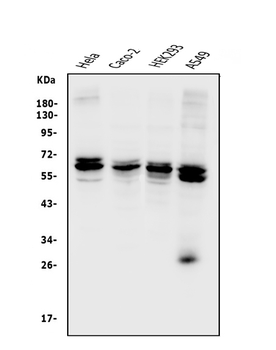 Anti-CDR2 Antibody