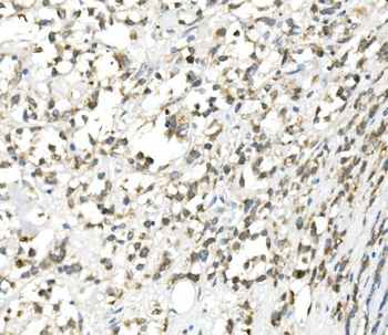 Anti-DDIT3 Antibody