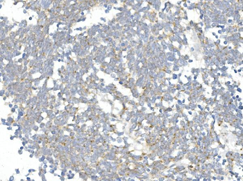 Anti-DDIT3 Antibody