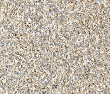 Anti-DDIT3 Antibody