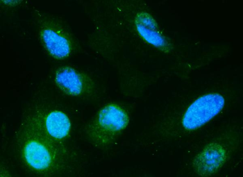 Anti-DIO1 Antibody