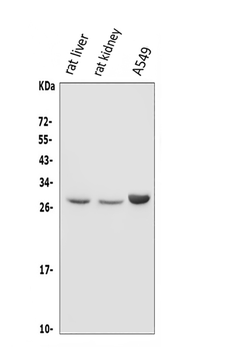 Anti-DIO1 Antibody