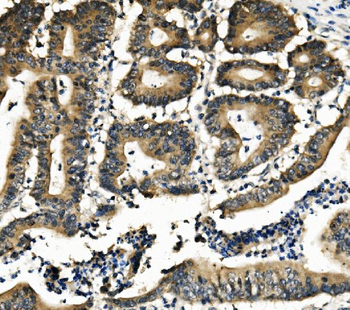 Anti-DNAJA2 Antibody