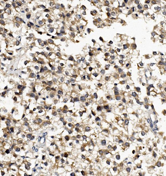 Anti-DNAJA2 Antibody