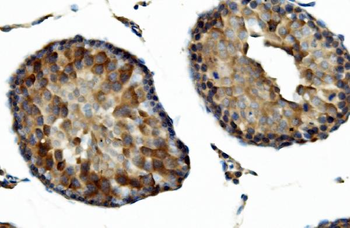 Anti-DNAJA2 Antibody