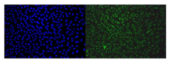 Anti-EAPP Antibody