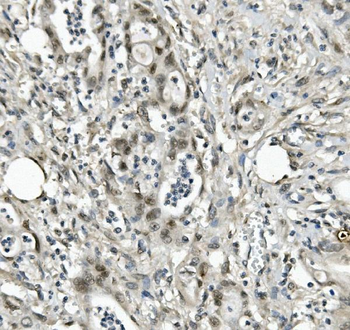 Anti-EAPP Antibody