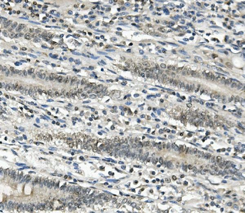 Anti-EAPP Antibody