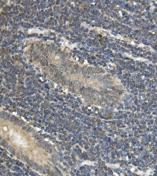 Anti-EAPP Antibody