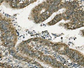Anti-FABP6 Antibody