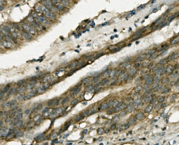 Anti-FABP6 Antibody