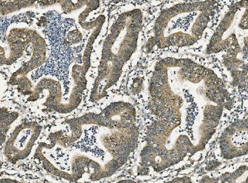 Anti-FABP6 Antibody