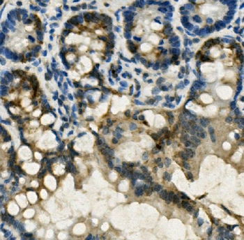 Anti-FABP6 Antibody