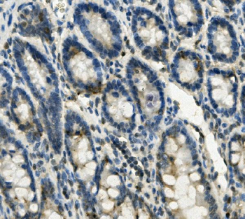Anti-FABP6 Antibody
