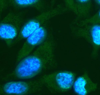Anti-FGF10 Antibody